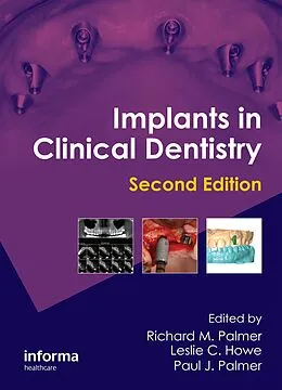 E-Book (pdf) Implants in Clinical Dentistry von Richard M. Palmer, Leslie C. Howe, Paul J. Palmer