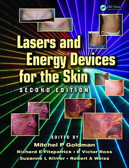 E-Book (pdf) Lasers and Energy Devices for the Skin von 