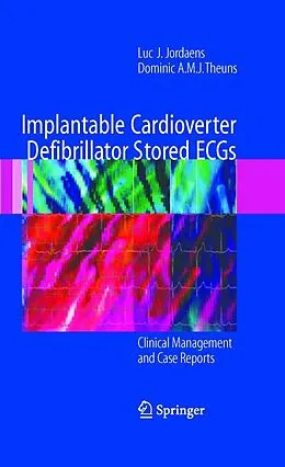 E-Book (pdf) Implantable Cardioverter Defibrillator Stored ECGs von Luc J. Jordaens, Dominic A. M. J. Theuns
