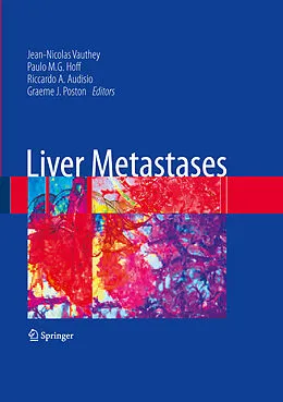 E-Book (pdf) Liver Metastases von Graeme J. Poston, Riccardo A. Audisio, Paulo M. Hoff