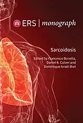 E-Book (epub) Sarcoidosis von Unknown