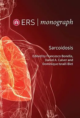 E-Book (epub) Sarcoidosis von Unknown