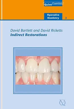E-Book (epub) Indirect Restorations von David Bartlett, David Ricketts