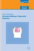 E-Book (epub) Decision-Making in Operative Dentistry von Paul A. Brunton