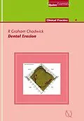 E-Book (epub) Dental Erosion von R. Graham Chadwick