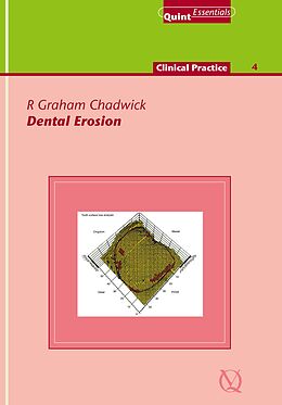 eBook (epub) Dental Erosion de R. Graham Chadwick