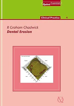 E-Book (epub) Dental Erosion von R. Graham Chadwick