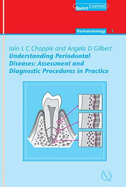 E-Book (epub) Understanding Periodontal Diseases: Assessment and Diagnostic Procedures in Practice von Iain L. C. Chapple, Angela Gilbert