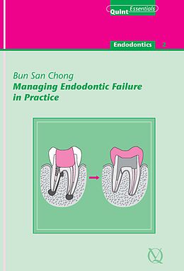 eBook (epub) Managing Endodontic Failure in Practice de Bun San Chong