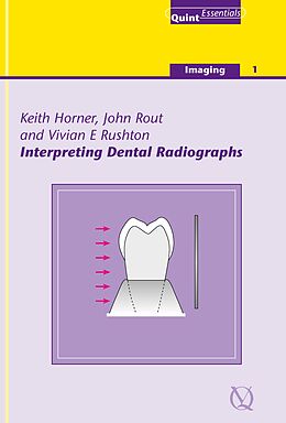 eBook (epub) Interpreting Dental Radiographs de Keith Horner, John Rout, Vivian E. Rushton