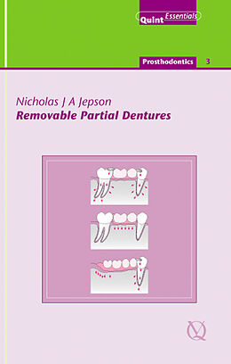 eBook (epub) Removable Partial Dentures de Nicholas J. A. Jepson