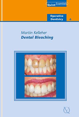 eBook (epub) Dental Bleaching de Martin Kelleher