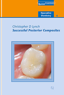 eBook (epub) Successful Posterior Composites de Christopher D. Lynch