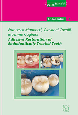 eBook (epub) Adhesive Restoration of Endodontically Treated Teeth de Francesco Mannocci, Massimo Gagliani, Giovanni Cavalli