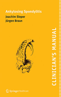 Couverture cartonnée Clinician's Manual on Ankylosing Spondylitis de Jürgen Braun, Joachim Sieper