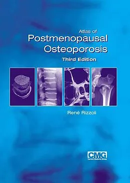 E-Book (pdf) Atlas of Postmenopausal Osteoporosis von René Rizzoli