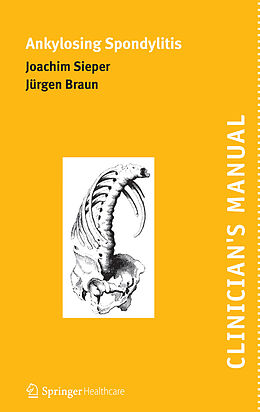 eBook (pdf) Clinician's Manual on Ankylosing Spondylitis de Joachim Sieper, Jürgen Braun