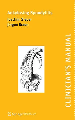 E-Book (pdf) Clinician's Manual on Ankylosing Spondylitis von Joachim Sieper, Jürgen Braun