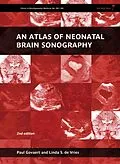 E-Book (epub) An Atlas of Neonatal Brain Sonography, 2nd Edition von Paul Govaert, Linda S De Vries