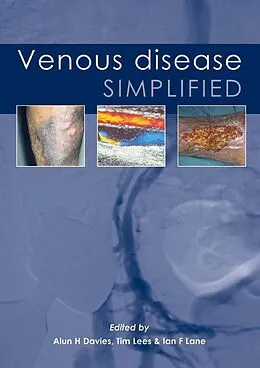 E-Book (epub) Venous Disease Simplified von Davies, Alun, H