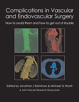 E-Book (epub) Complications in Vascular and Endovascular Surgery von Jonothan J Earnshaw
