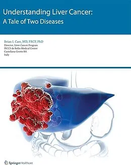 E-Book (pdf) Understanding Liver Cancer von Brian I. Carr