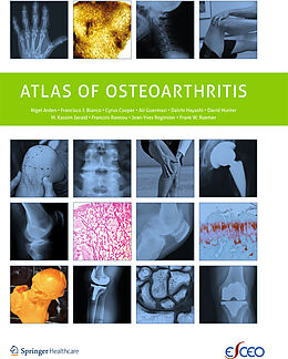 Kartonierter Einband Atlas of Osteoarthritis von Nigel Arden, Daichi Hayashi, Francisco Blanco
