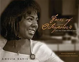 E-Book (epub) Faces of Osteoporosis von Amelia Davis