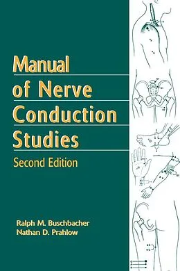 E-Book (pdf) Manual of Nerve Conduction Studies, Second Edition von Ralph Buschbacher, Nathan D. Prahlow