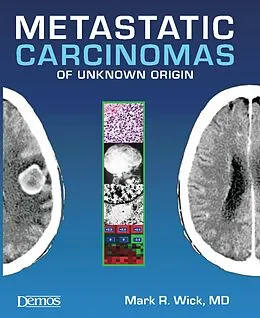 E-Book (pdf) Metastatic Carcinomas of Unknown Origin von Mark R. Wick