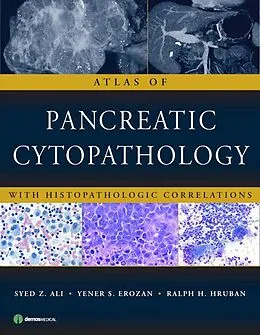 E-Book (pdf) Atlas of Pancreatic Cytopathology von Syed Z. Ali, Yener S. Erozan, Ralph H. Hruban