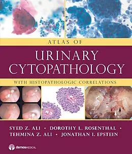 E-Book (pdf) Atlas of Urinary Cytopathology von Syed Z. Ali, Tehmina Z. Ali, Jonathan I. Epstein