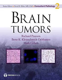 E-Book (epub) Brain Tumors von Mark Cohen, Bette K. Kleinschmidt-Demasters, Richard Prayson