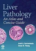 E-Book (epub) Liver Pathology von Arief A Suriawinata, Swan N. Thung