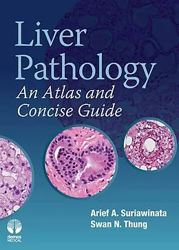E-Book (epub) Liver Pathology von Arief A Suriawinata, Swan N. Thung