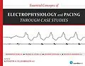 E-Book (pdf) Essential Concepts of Electrophysiology and Pacing through Case Studies von Roderick Tung, Prabal Guha