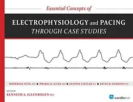 E-Book (pdf) Essential Concepts of Electrophysiology and Pacing through Case Studies von Roderick Tung, Prabal Guha