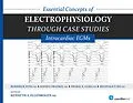 E-Book (pdf) Essential Concepts of Electrophysiology through Case Studies: Intracardiac EGMs von Roderick Tung, David Frankel