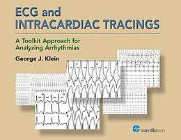E-Book (pdf) ECG and Intracardiac Tracings von George J. Klein