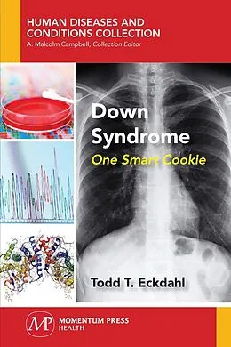 E-Book (epub) Down Syndrome von Todd T. Eckdahl