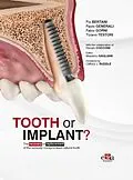 E-Book (epub) Tooth or Implant? von Pio Bertani, Paolo Generali, Fabio Gorni