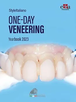 E-Book (epub) One-day Veneering von Styleitaliano