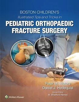 E-Book (epub) Boston Children's Illustrated Tips and Tricks in Pediatric Orthopaedic Fracture Surgery von Peter M. Waters, Daniel Hedequist