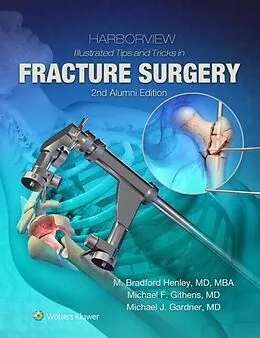 E-Book (epub) Harborview Illustrated Tips and Tricks in Fracture Surgery von M. Bradford Henley, Michael F. Githens, Michael J. Gardner