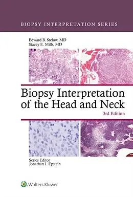 E-Book (epub) Biopsy Interpretation of the Head and Neck von Edward B. Stelow, Stacey Mills