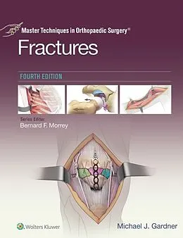 E-Book (epub) Master Techniques in Orthopaedic Surgery: Fractures von Michael J. Gardner