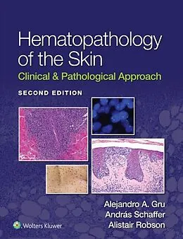 E-Book (epub) Hematopathology of the Skin von Alejandro A. Gru, Andras Schaffer, Alistair Robson