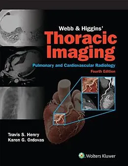 E-Book (epub) Webb &amp; Higgins Thoracic Imaging: eBook with Multimedia von Travis S. Henry, Karen G. Ordovas