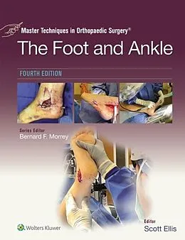 E-Book (epub) Master Techniques in Orthopaedic Surgery: The Foot and Ankle von Scott Ellis