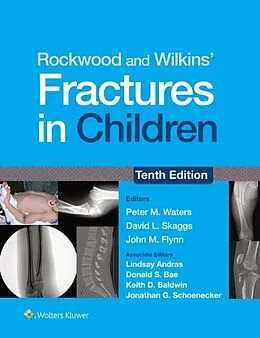 E-Book (epub) Rockwood and Wilkins' Fractures in Children von Peter M. Waters, David L. Skaggs, John M. Flynn